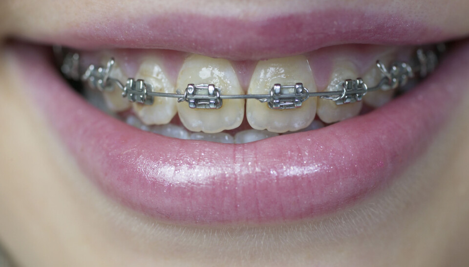 GRATIS OG OFFENTLIG: I dag er det i hovedsak private tannleger som utfører tannregulering for barn og unge, men det vil utvalget ha slutt på.