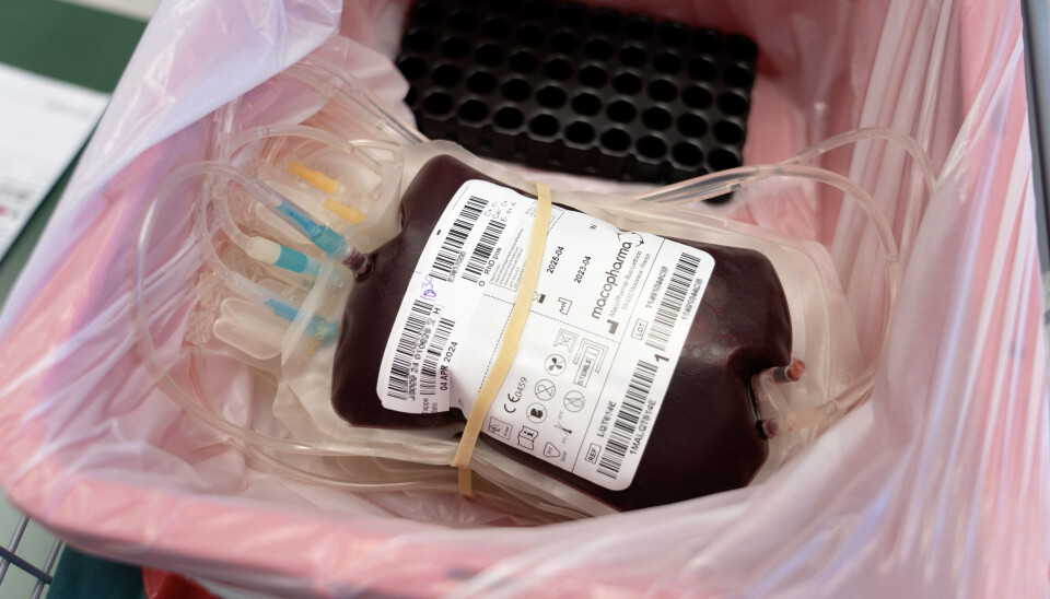 Ved allogen stamcelletransplantasjon erstattes pasientens blodstamceller med friske stamceller fra en donor. Risikoen for komplikasjoner ved en slik behandling er høy, men pilene peker rett vei. Foto: Gorm Kallestad / NTB