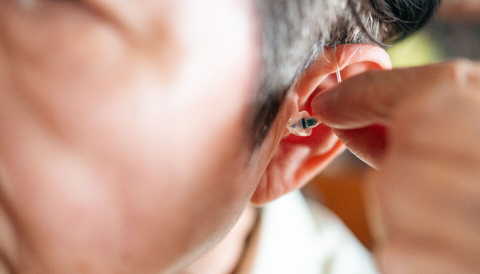 For å få best mulig nytte av høreapparat kreves mer enn teknologi. Det trengs god diagnostikk, individuell tilpasning og tett oppfølging, skriver innleggforfatterne, som argumenterer for en helhetlig strategi.