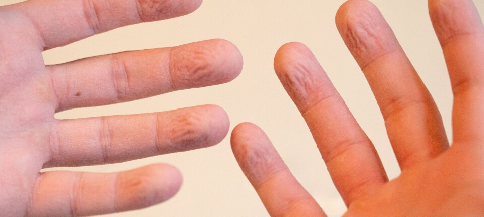 Forskning: Derfor får vi rosinfingre når vi bader