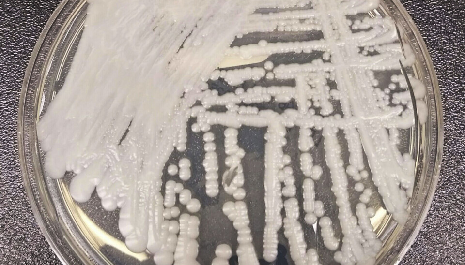 Den potensielt dødelige gjærsoppen C. Auris er motstandsdyktig mot vanlige antibiotika og kan utgjøre en dødelig risiko for pasienter på sykehus og sykehjem. Her er en stamme av C. auris dyrket i en petriskål ved et laboratorium. Foto: Shawn Lockhart / ECDC / AP / NTB