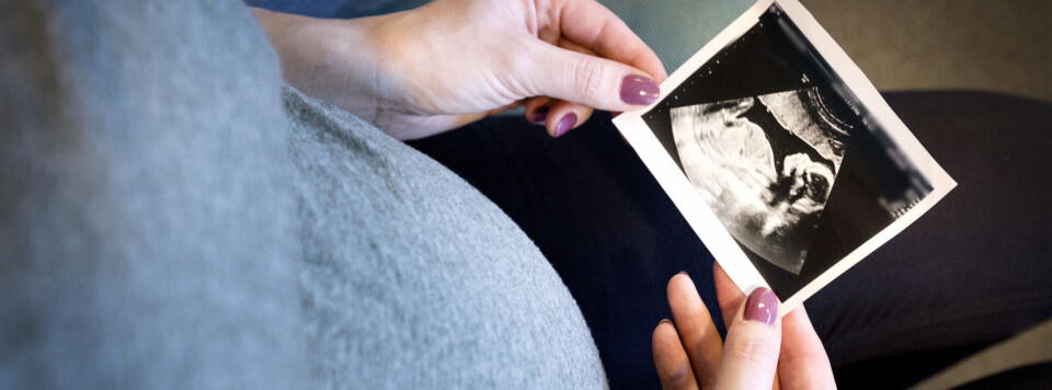 Denne gruppen har risiko for endometriose